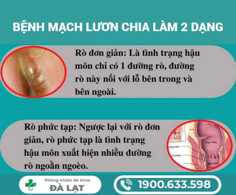 Hình ảnh minh họa